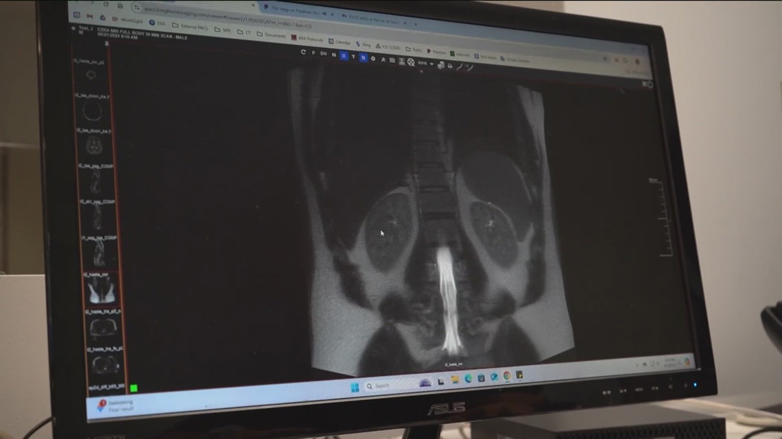 New York company bringing AI-powered MRIs to help detect cancer [Video]