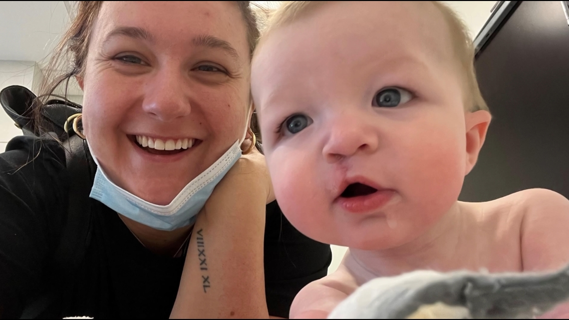 Charlotte dentist pushing for cleft palate surgery cost awareness [Video]