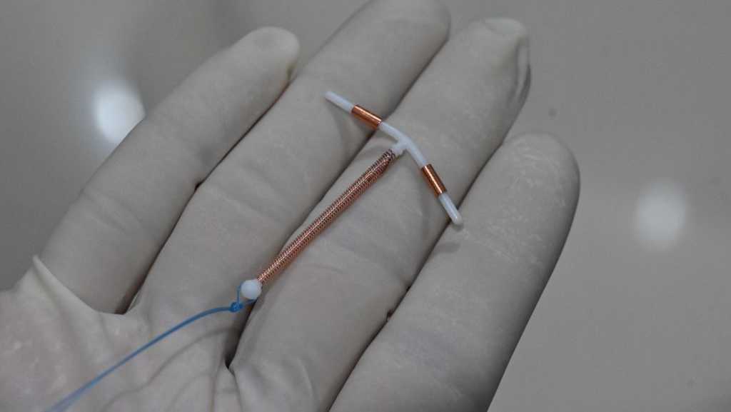 Getting an IUD can hurt. New guidelines say doctors should help patients manage the pain [Video]