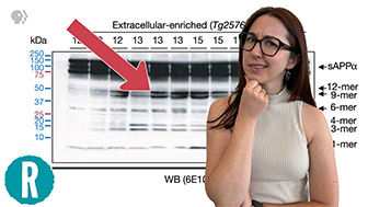 How a retracted paper affected the course of Alzheimers research (video)