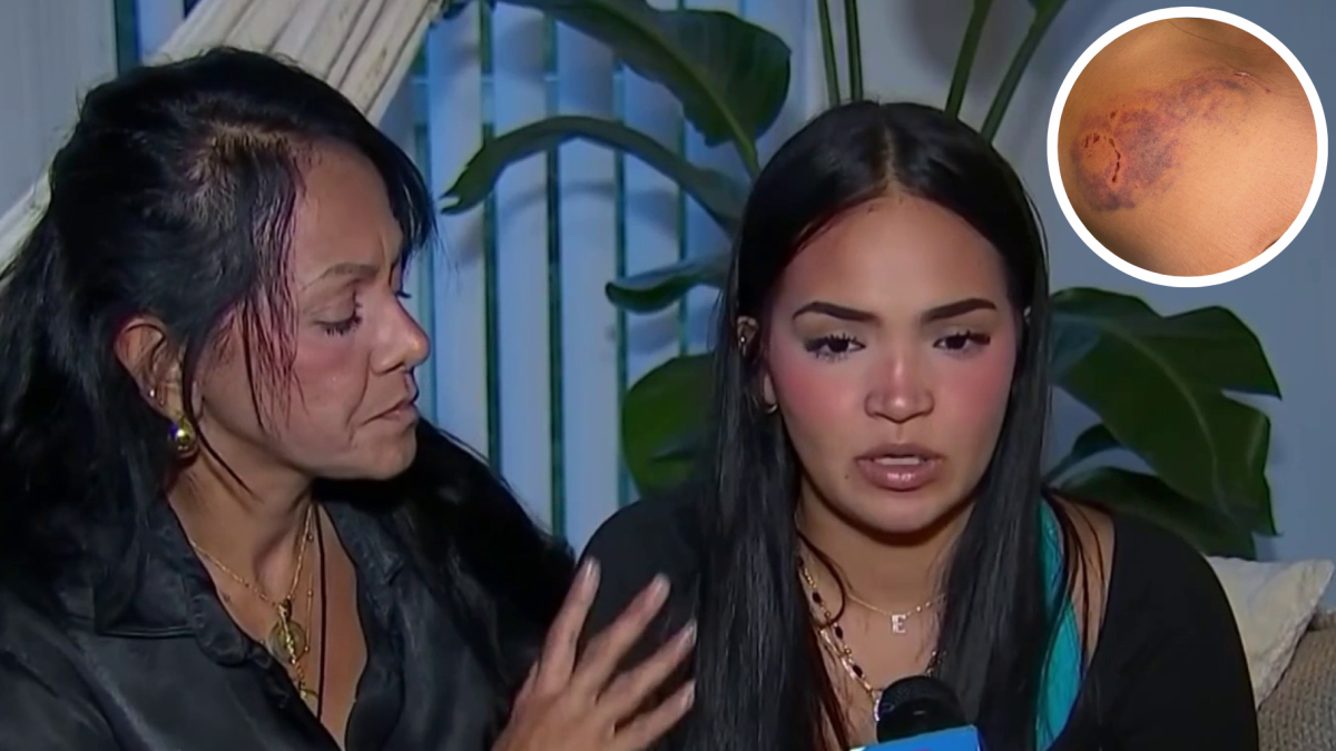 TikToker, mom describe attack by ex-stepdad  NBC 6 South Florida [Video]