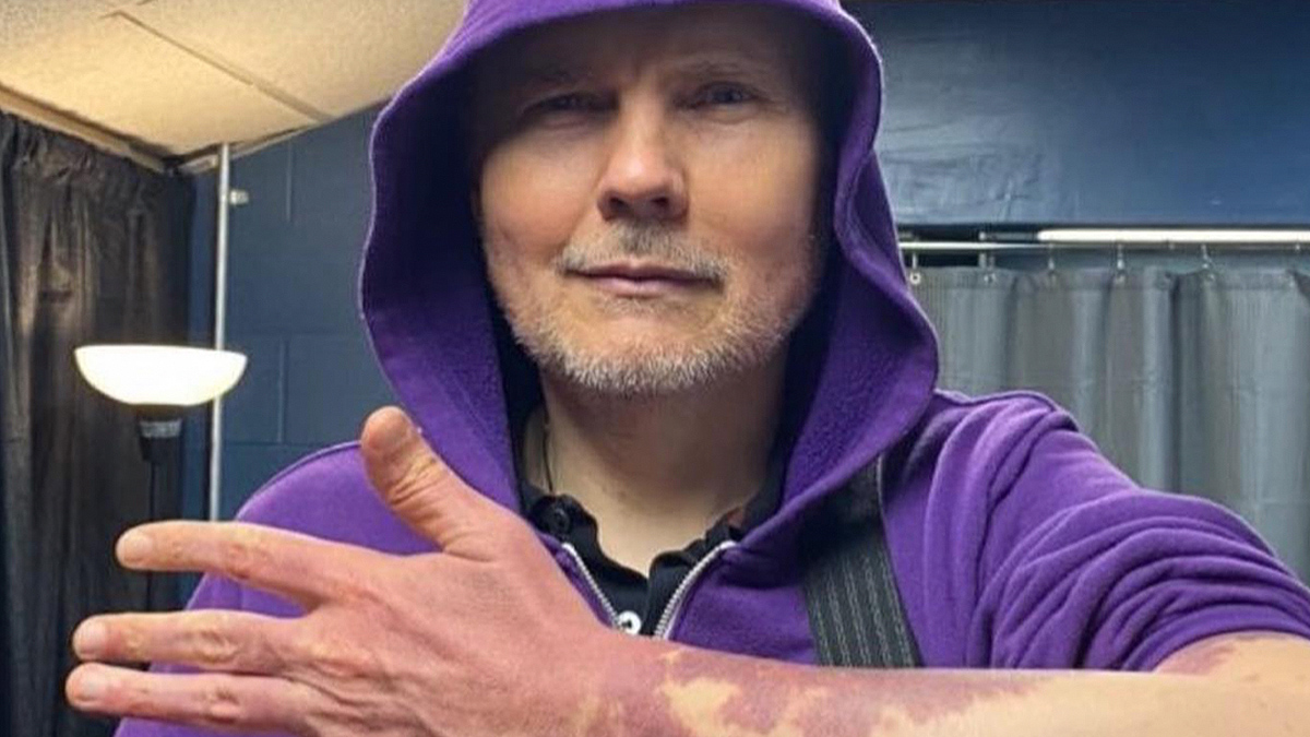 Billy Corgan Shows Off Birthmarks in Body Positivity Message [Video]