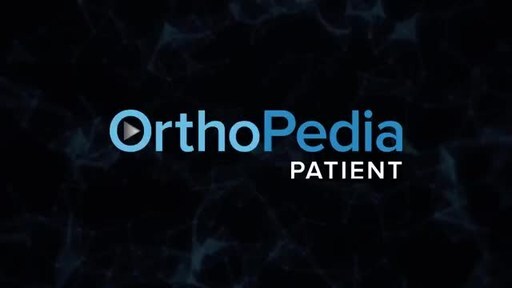 Arthrex Launches Online Learning Tool for Orthopedic Patients [Video]