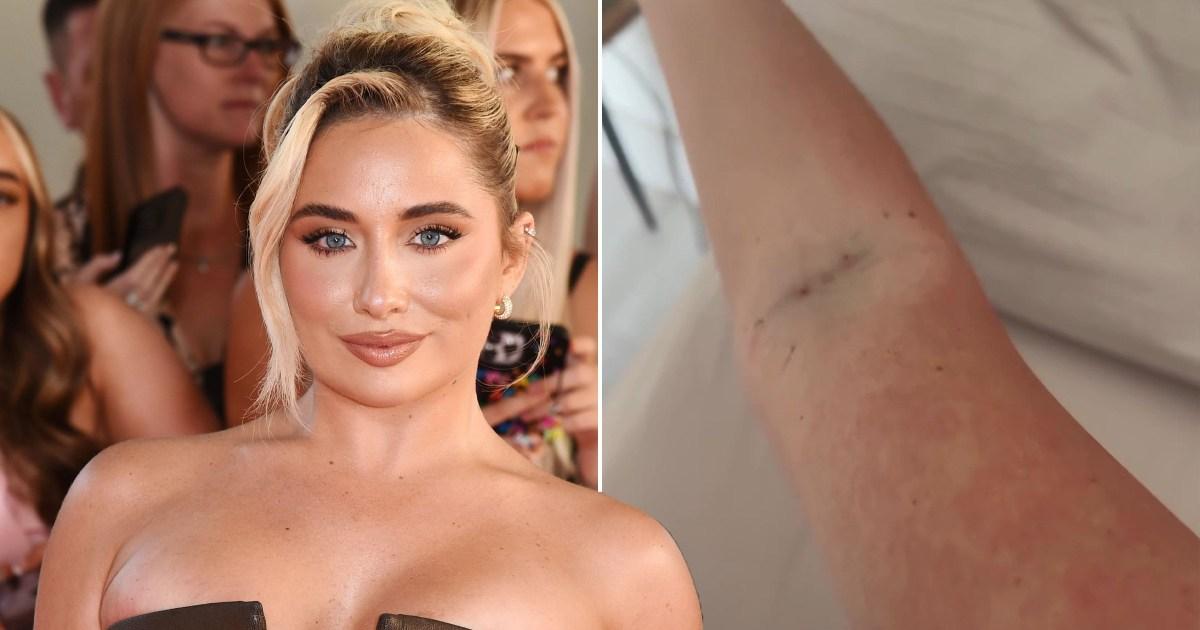 Strictly Come Dancing star hospitalised with suspected ‘tropical disease’ [Video]