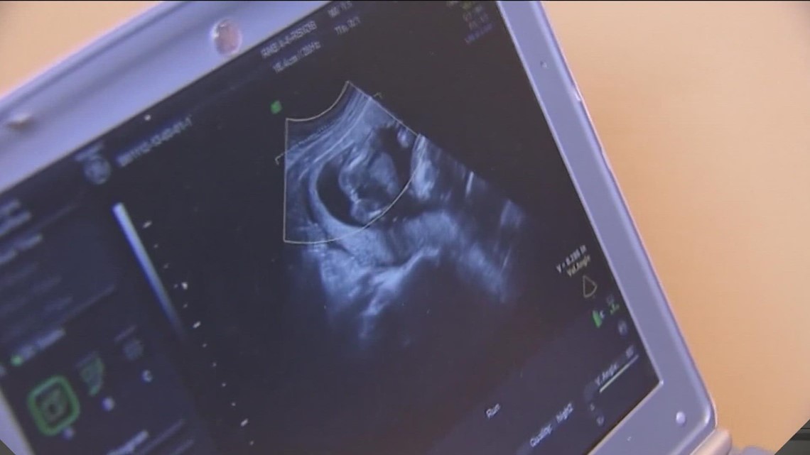 How Texas’s abortion ban is impacting OB/GYNs: report [Video]