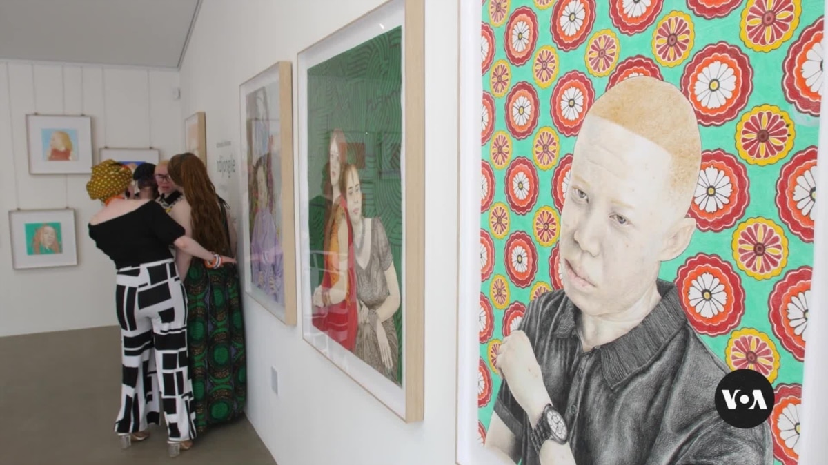 South African artists, influencers with albinism fight stigma [Video]