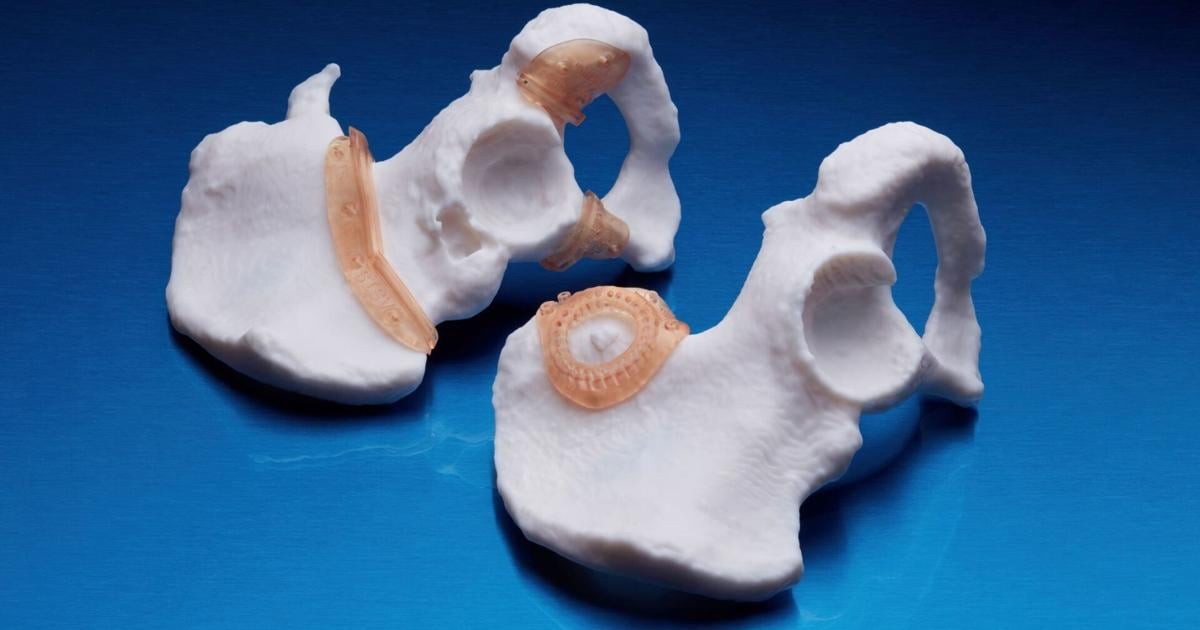 RICOH 3D for Healthcare and Insight Surgery join forces to offer patient-specific orthopedic and maxillofacial guides | PR Newswire [Video]