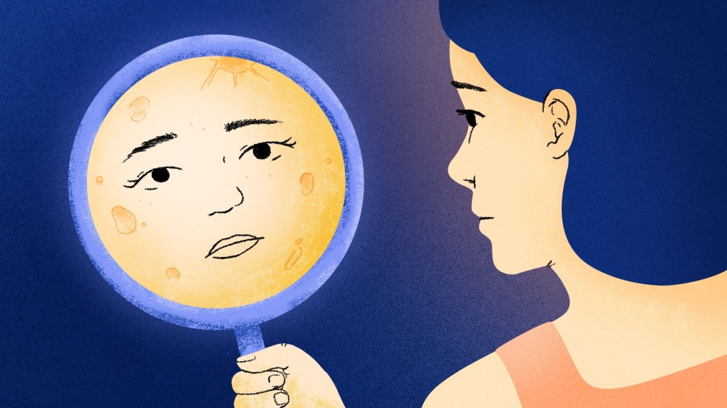 Stress and moon face: What experts say [Video]