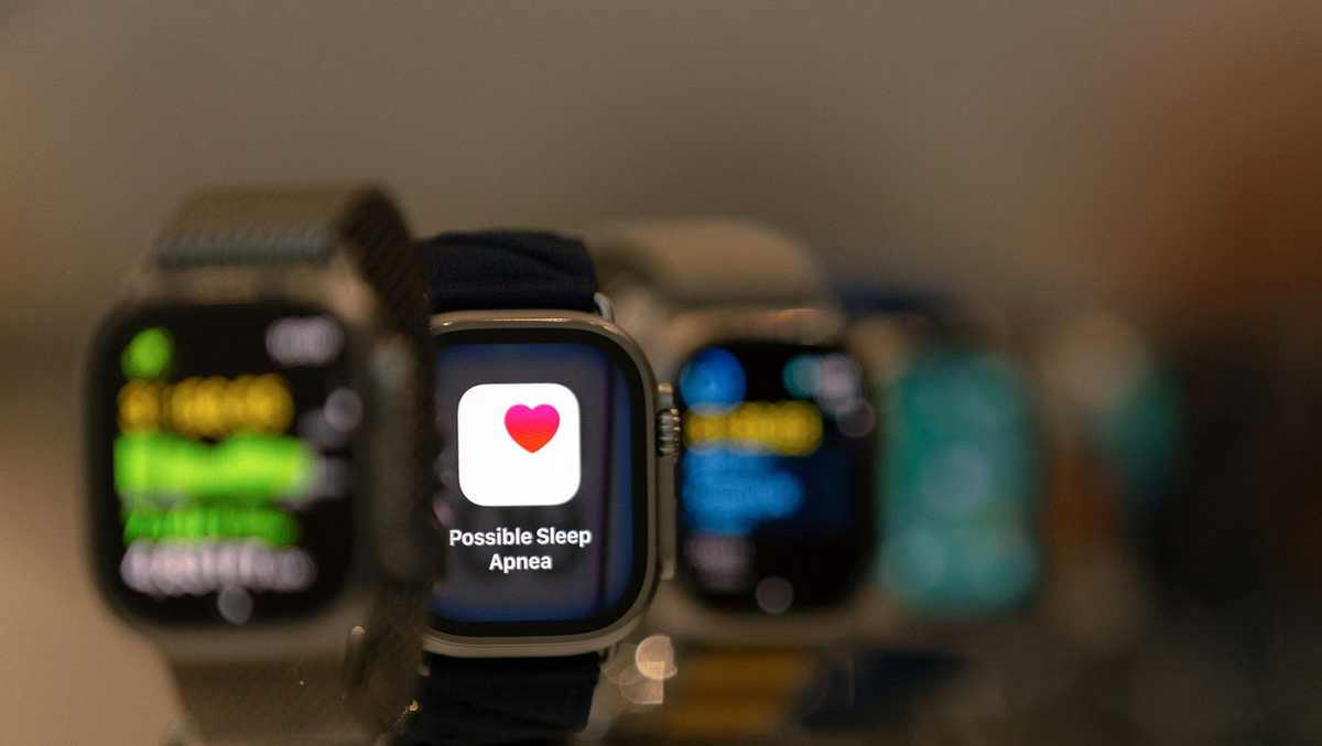 If your Apple Watch alerts you to sleep apnea, heres what it means and what to do next [Video]