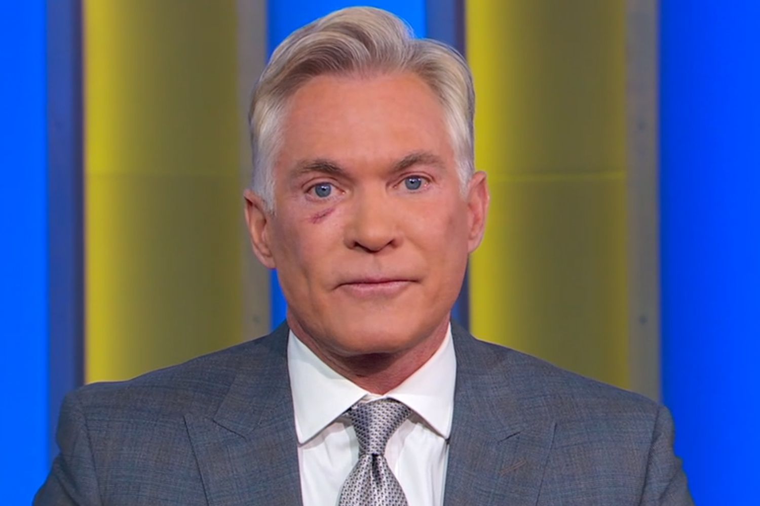 Sam Champion Shows Skin Cancer Scar on First Day Back at GMA [Video]