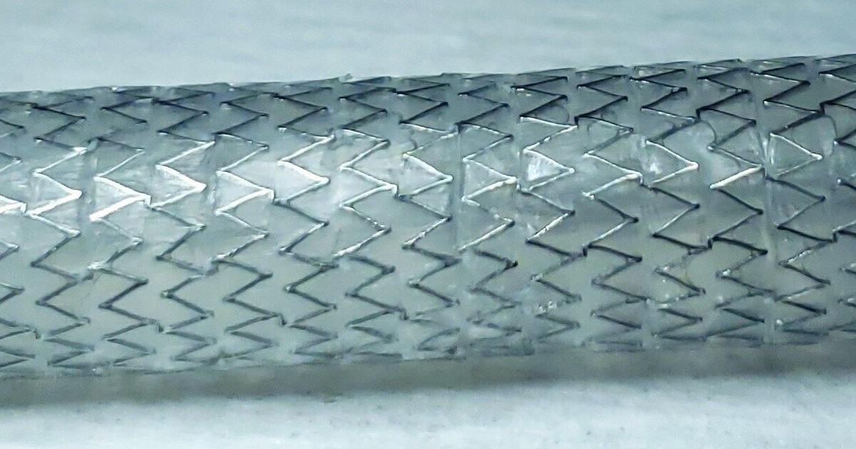 Peytant Solutions, Inc. Granted FDA De Novo for AMStent Tracheobronchial Covered Stent System | PR Newswire [Video]