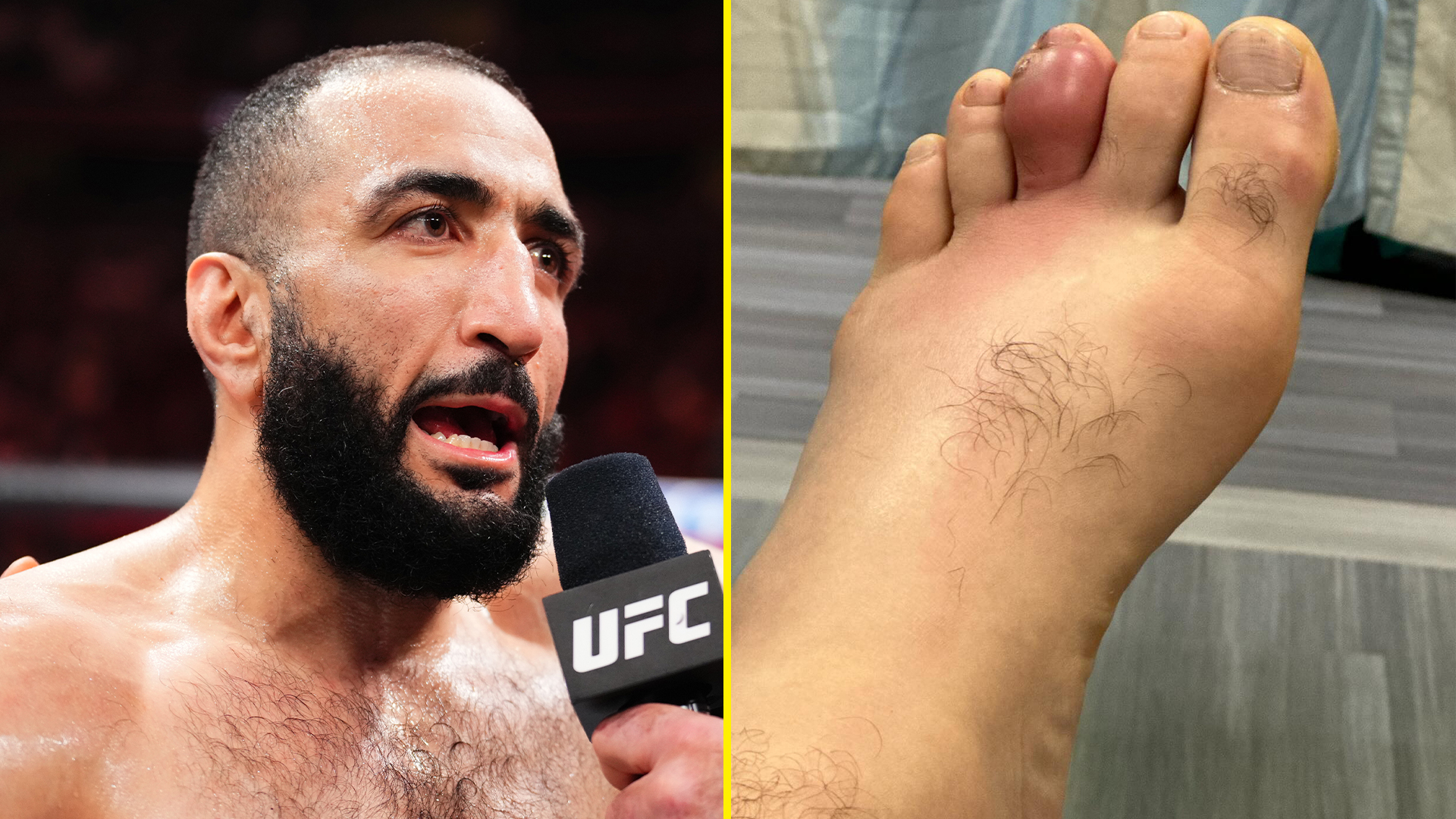 Conor McGregor reacts to champion’s grotesque foot infection as Alex Pereira ‘approached’ for UFC 310 [Video]