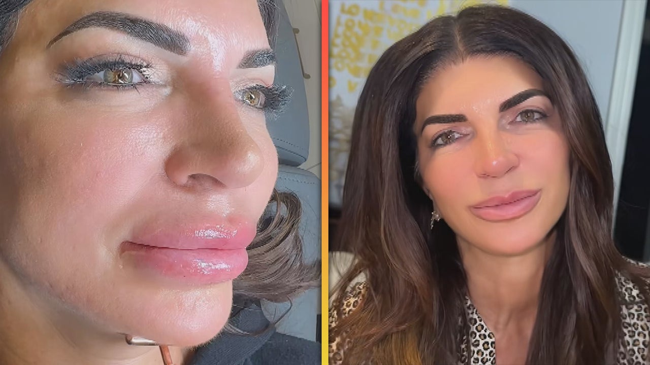 Teresa Giudice Films Herself Removing Lip Filler [Video]