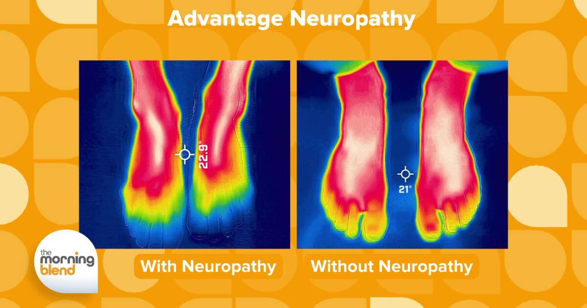 Neuropathy Made Painless [Video]