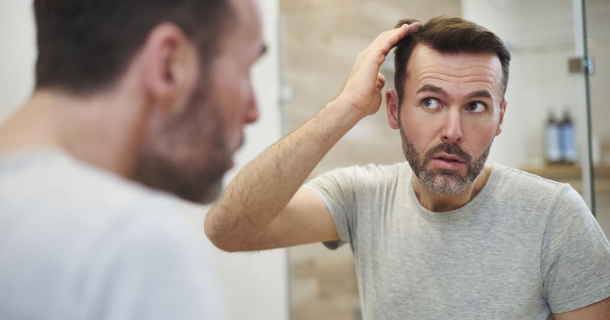 Ranking Popular Hair Loss Brands [Video]