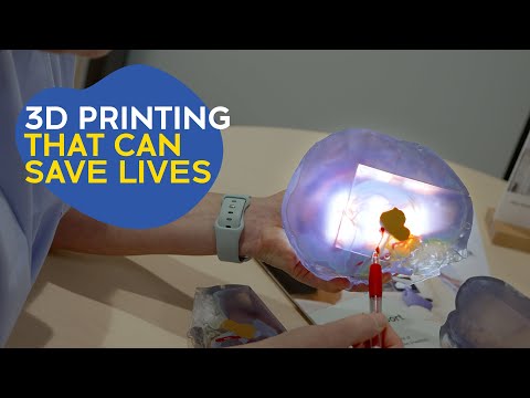 How 3D printing body parts can be used in surgical planning [Video]