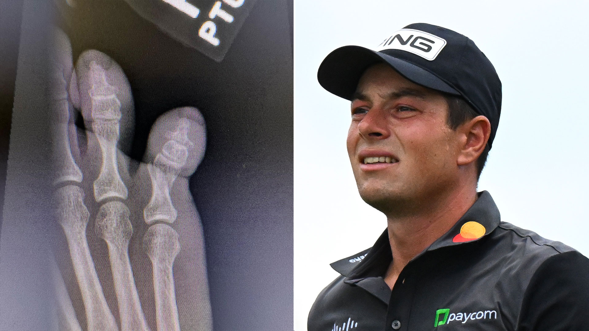 Golf star Viktor Hovland suffers freak bedroom injury as he shares X-ray picture [Video]