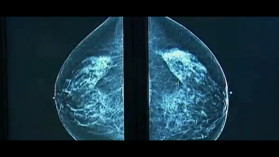 TTUHSC pilot program offers breast exams to rural Texans [Video]