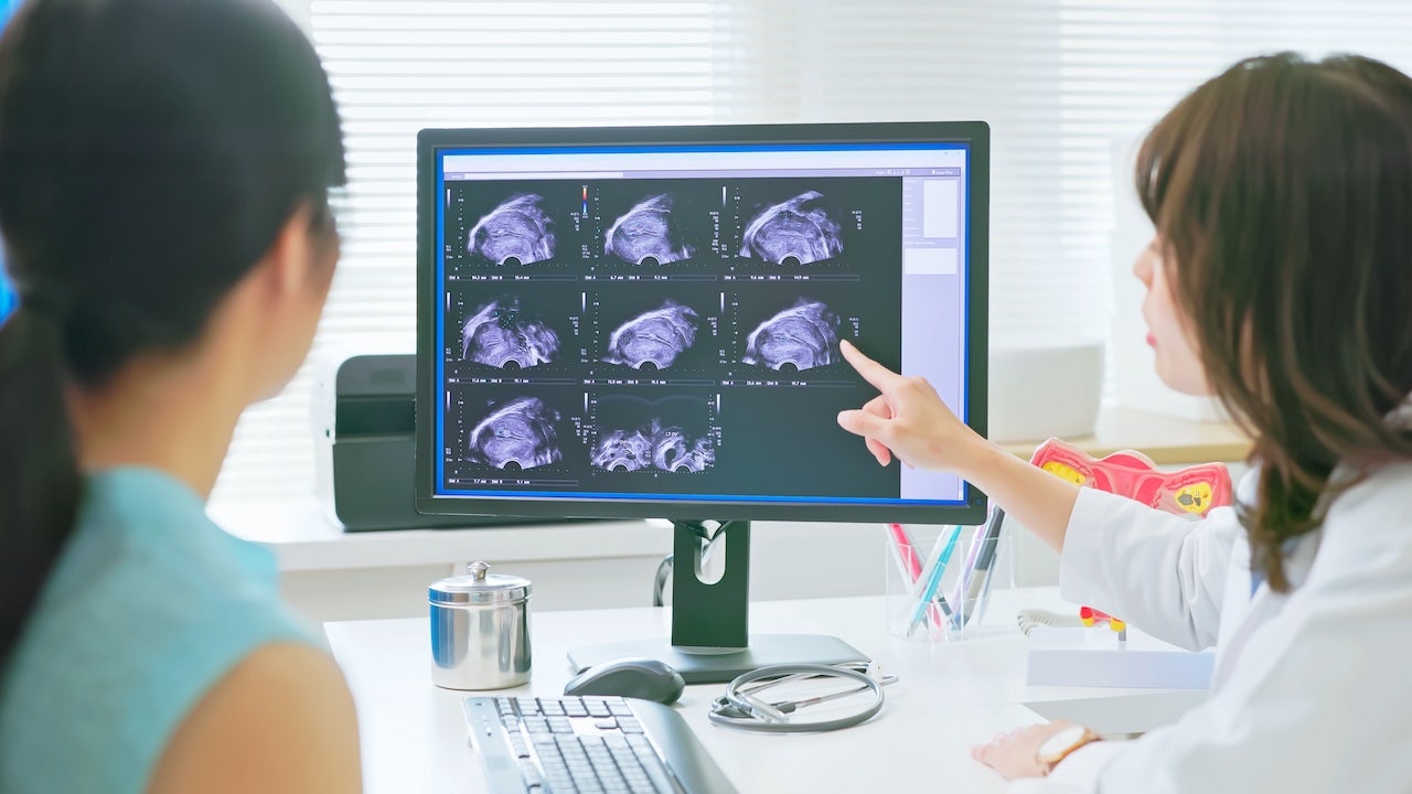 AI detects ovarian cancer better than human experts in new study [Video]